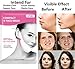 Face Slimming Mask V Line Lifting Chin Up Mask Patch Facial Firming Moisturizing Mask Double Chin Reducer Mask Lift V Reshape Face Mask for Women Men Round Face, Fat Face (4 Pack)