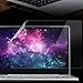 14″(304mm190mm) Privacy Filter Anti-Glare Screen Protective Film for Notebookthumb 3