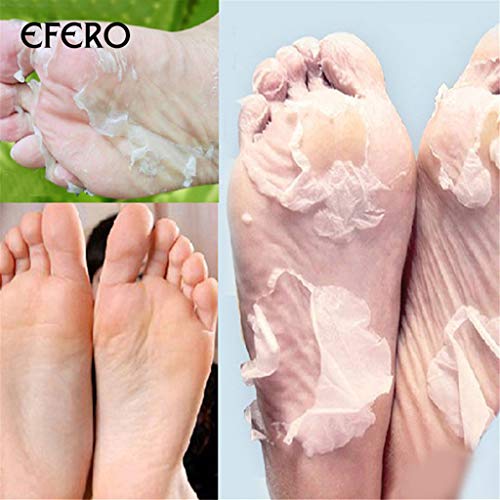 Foot Peel Mask, Cracked Heel Treatment Foot Peeling Mask Dead Skin Remover for Feet Baby Soft Foot Mask 1 Pair (B)