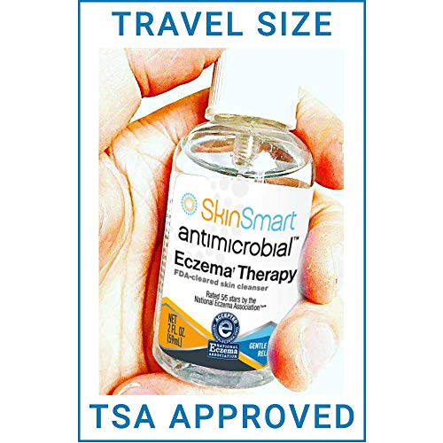 SkinSmart Eczema Therapy Removes Bacteria, so Your Skin Can Heal, Travel Size 2 Ounce Spray (Pack of 3)