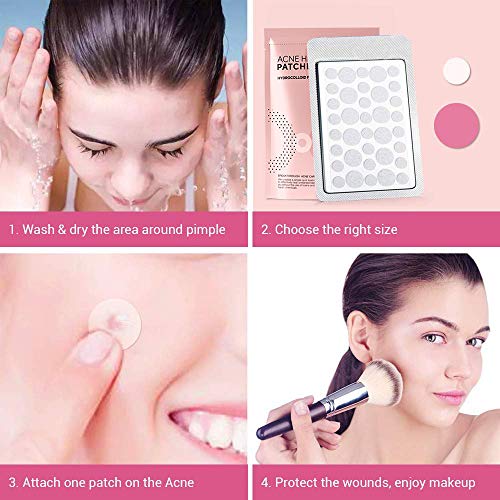 OHeal Acne Pimple Master Patch 108 dots - Absorbing Hydrocolloid Blemish Spot Skin Treatment (108 Patches, 3Pack)
