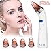 Blackhead Remover Facial Pore Vacuum Skin Acne Come-do Suction Electric Cleanser Extractor Removal Tool USB Rechargeable