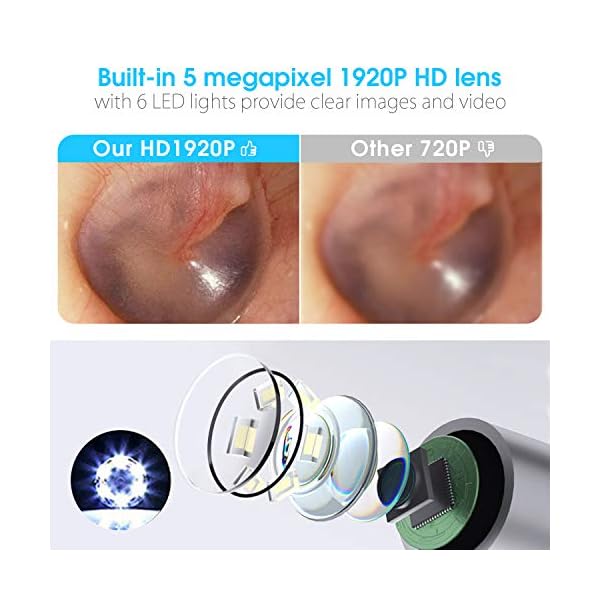 Ohr Otoskop VITCOCO 3.0mm WiFi Ohr Endoskop 5MP 1920P HD Ohr Endoskopkamera mit 6 LED Licht 2020 Neues Upgrade… – Bild 3