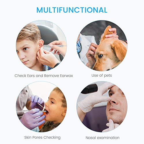 Anykit USB Otoscope for PC & Android Device(NOT for iPhone/iPad), Ultra