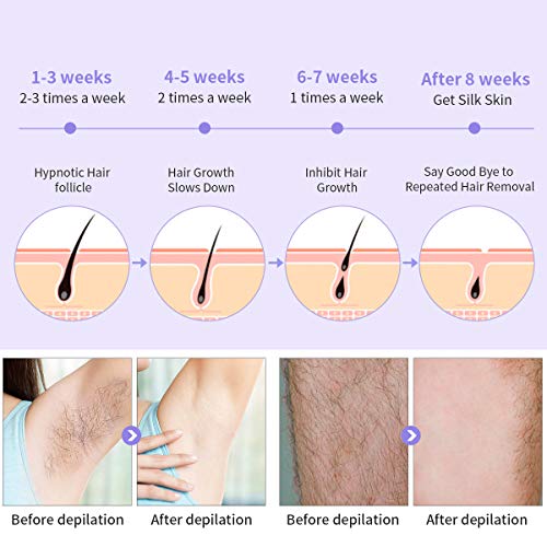 IPL Laser Facial Hair Removal for Women -500,000 Flashes Painless Permanent Hair Remover