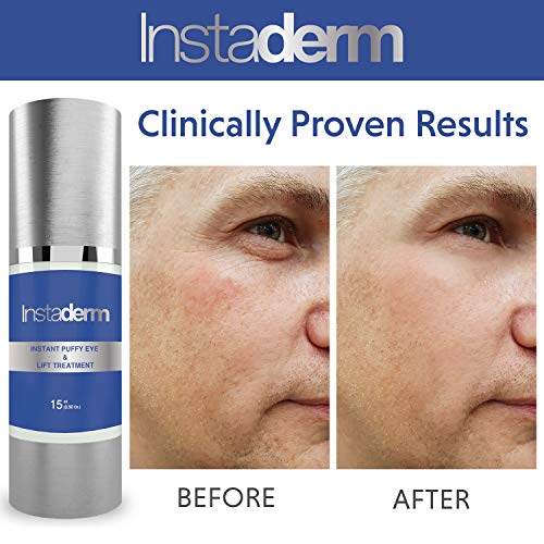 Instant Puffy Eye & Lift Treatment Removes Under Eye Bags & Puffiness