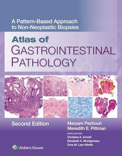 Amazon.com: Diagnostic Histopathology of Tumors E-Book: Expert