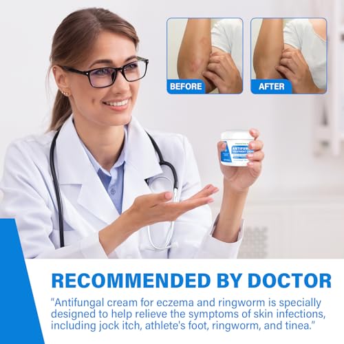 Skin Fungus Cream, Foot Fungus Relief Quick Intensive, Antibody Ringworm, Eczema, Sweat Bubbles, Non-Irritating, Suitable for Face and Body Care, 60 g