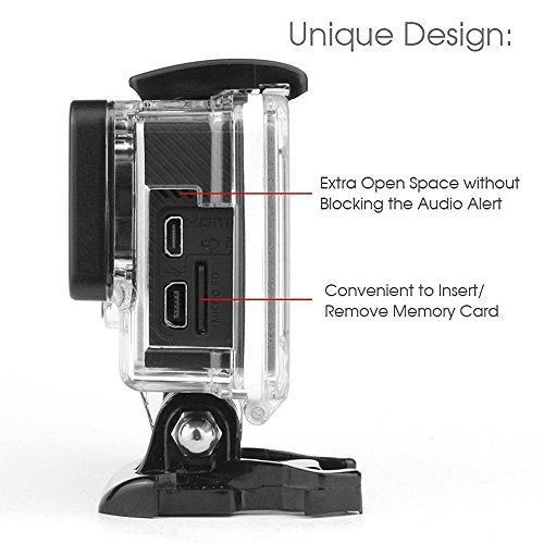 image for SOONSUN Clear Skeleton Housing Side Open Protective Case with Skeleton