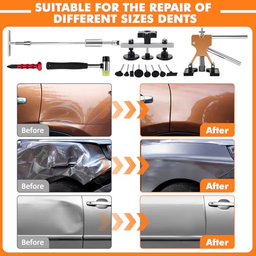 KAOLALI Body Puller Kit of 78 Paintless Dent Puller Kit - Suction Cup Body Puller for Car Dent Removal on Vehicles/Doors