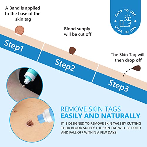2 Size Automatic Removal Pen Set, Effective, Painless, Easy And Safe For Small To Large Size Warts And Moles (1-9 MM)