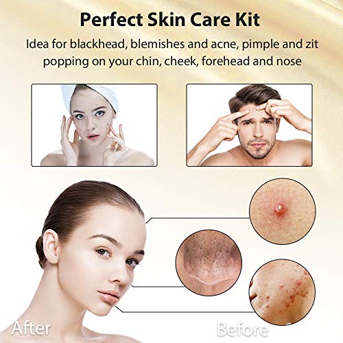 Blackhead Remover Pimple Extractor Tool, Terresa 8pcs Blackhead Extractor, Comedone Extractor Acne Removal Kit for Blemish, Whitehead Popping, Zit Removing for Nose Face with Leather Bag - Thumbnail 5