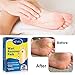 Wart Remover, Corn Remover Pads, Foot Corn Removal Plaster with Hole, Professional Removes Common and Plantar Warts, Callus, Soften Skin Cutin Sticker Cure Toe Protector,Stops Wart Regrowth 24 Pcs/Boxthumb 3