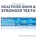 Crest Pro Health Extra Whitening Toothpaste Fresh Clean Mint 5.1 oz(144g) - Pack of 2