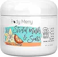 stretch mark body cream