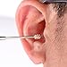 Ear Wax Removal by DigHealth(TM), Stainless Steel Ear Pick, Earwax Removal With Storage Box - Ear Wax Remover