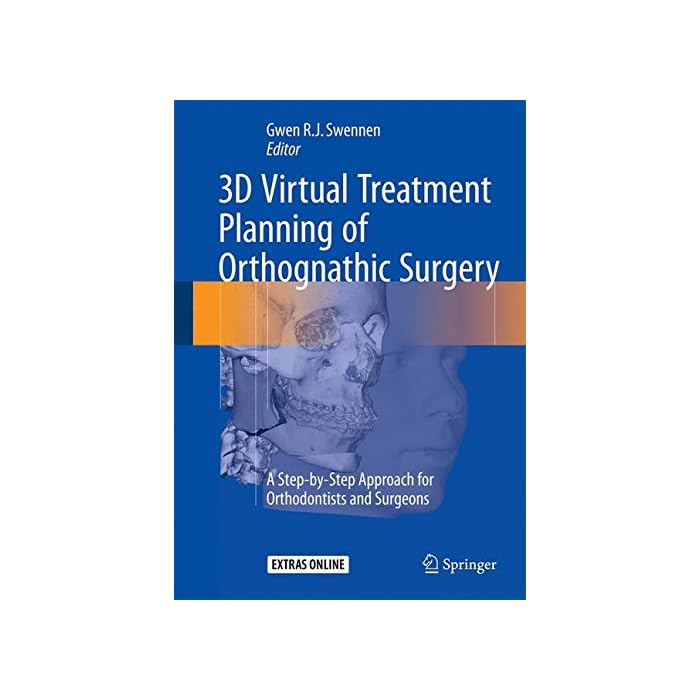 Buy 3D Virtual Treatment Planning of Orthognathic Surgery A Stepby