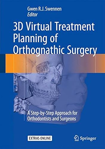 Download 3D Virtual Treatment Planning of Orthognathic Surgery: A Step-by-Step Approach for Orthodontists and Surgeons PDF