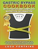 Gastric Bypass Cookbook with Photos and Complete Nutrition Information: Weight Loss Surgery Recipes and Meal Plan For Gastric Bypass, Gastric Sleeve, Lap Band, and Other Bariatric Surgery