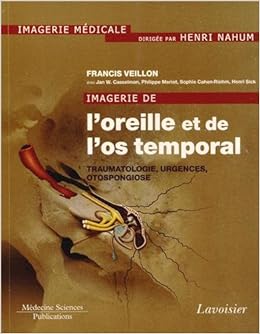Amazon Fr Imagerie De L Oreille Et De L Os Temporal Tome 3 Traumatologie Urgences Otospongiose Veillon Francis Collectif Harmsworth Vicky Jade Becker Minerva Livres