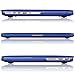 Kuzy Compatible with MacBook Pro 15.4 inch Case Model A1398 with Retina Display Soft Touch 15 inch Plastic Hard Shell Cover for Older MacBook Pro 15.4 inch, Navy Blue