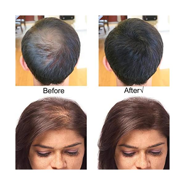 SEVICH Hair Fibers - Hair Rebuilding Fibers Original Refill, Nature Keratin Fibers for Thin Hair, 100g - Dark Brown