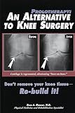 Prolotherapy: An Alternative to Knee Surgery