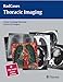 Thoracic Imaging (Radcases)