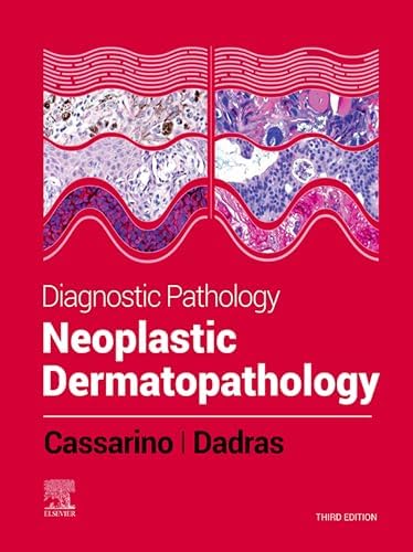 Amazon.com: Surgical Pathology of the Liver eBook : Torbenson