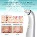 Electric Blackhead Comedone Extractor HURRISE 4 in 1 Powerful Suction Comedo Microdermabrasion Machine Clean Facial Pore Safety Necessary Tool for Skin Care and Holiday Gift