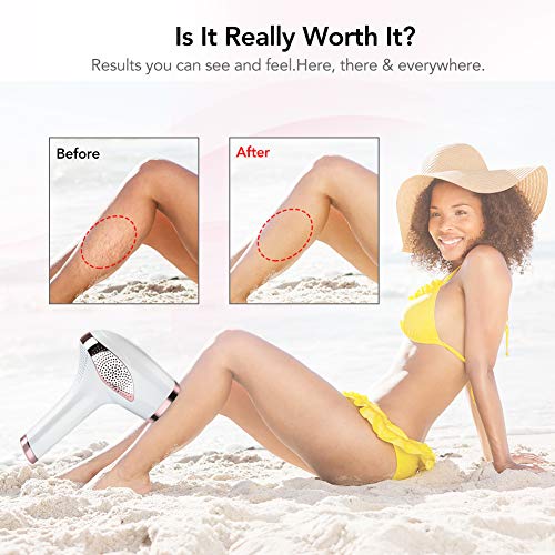 IPL Hair Removal Device - Permanent Hair Removal Electric Painless Perfect Hair Remover for Face, Armpit, Chin and Full Body, FDA Approved with Sunglasses (ICE COLD)