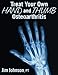 Treat Your Own Hand and Thumb Osteoarthritis