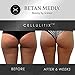 Betan MediX Proven by Plastic Surgeons: Cellulite Cream and Massager - CellulitiX