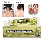 GARYOB Antibacterial Cream Natural Gentle Repair Psoriasis Eczema Dry Itching, Chinese Herbal Cream for Skin Disease Treatment