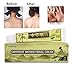 GARYOB Antibacterial Cream Natural Gentle Repair Psoriasis Eczema Dry Itching, Chinese Herbal Cream for Skin Disease Treatment