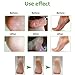 Foot Cream, Foot Mask, Callus Remover Cream, Foot Repair Cream with olive oil Moisturizes and Rehydrates Feet - For Thick, Cracked, Rough, Dead & Dry Feet