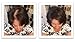Hair Powder For Thinning Hair. Makes Thin Hair Look 10X Fuller, Covers Bald Spot Instantly. All-Natural Hair Building Fiber. Trial Size (10-Day Supply). Black