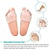 DOACT Gel Toe Separators & Bunion Corrector with Metatarsal Pads Forefoot Cushion Prevent Callus Blister Hallux Valgus Hammer Toe Straightener for Men and Women
