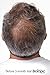 Keratin Hair Growth Conditioner, 8 Ounces