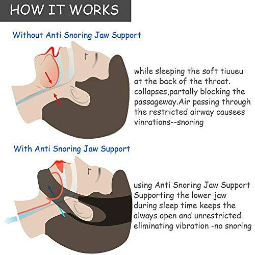 Anti Snoring Chin Strap – Two Snoring Chin Straps Kit- Adjustable Size, Comfy & Padded Fit -Most Effective Snoring Solution and Anti Snoring Devices Stop Snoring Sleep Aid for Men and Women