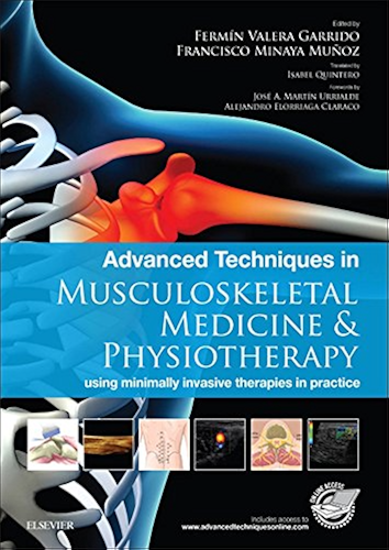 Download Advanced Techniques in Musculoskeletal Medicine & Physiotherapy - E-Book: using minimally invasive therapies in practice (English Edition) PDF