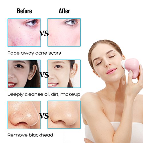 image for ZLiME Sonic Facial Cleansing Brush Waterproof Deep Cleaning Pore Spini