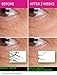 Venin Royale - Snake Venom Anti-Aging and Anti-Wrinkle Peptide Serum for Fine Lines, Rosacea, Uneven Tone | Best Skin Care for Face, Hands & Neck | Neuropeptide Treatment & Botox Cream (1.7oz)
