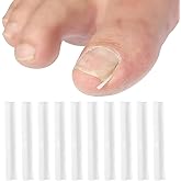 Ingrown Toenail Kit, 10Pcs White Ingrown Toenail Correction Strips Brace Kit, Strips Recover Clips Toenails Thick Pedicure To