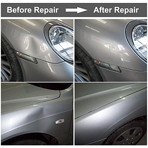 GLISTON Auto Dent Puller Removal, Paintless Dent Repair Kit, Slide Hammer kit with 13pcs