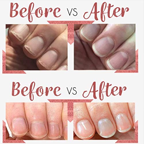 Rose Nail Paraffin Wax Nail Care Nail Treatment, Hand Wax White