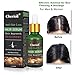 Hair Growth Serum, Hair Loss and Hair Thinning Treatment, Stops Hair Loss, Thinning, Balding, Repairs Hair Follicles, Promotes Thicker, Stronger Hair and New Hair Growththumb 4