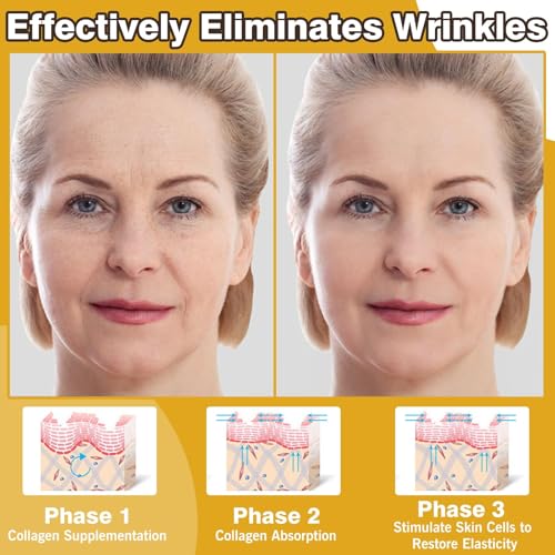 LBOYLOVE® Bee Venom Comprehensive Cream– All in One Bee Venom Cream for Deep Wrinkle Reduction, Firming Face C-ream & Hydration, Anti Aging Face C-ream with Peptide – 60g