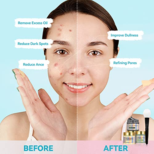 Clay Mask, Face Masks Skincare, Turmeric, Dead Sea Mud, Green Tea Face Mask, Facial Mask Set for Deeply Cleansing, Pores, Acne, and Oil Control - 3x70g