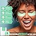 SAFISA Under Eye Patches | aloe vera gel under eye pads 10 pairs | under eye bags treatment, eye mask for puffy eyes, dark circles under eye treatment | anti-aging collagen eye mask | for women & men…